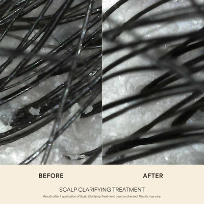 Scalp Clarifying Treatment