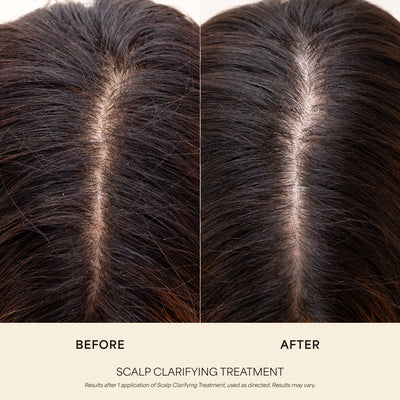 Scalp Clarifying Treatment